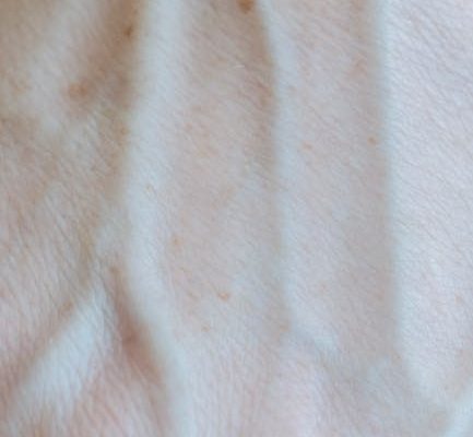 The Science Behind Why Fasting Clears Skin
